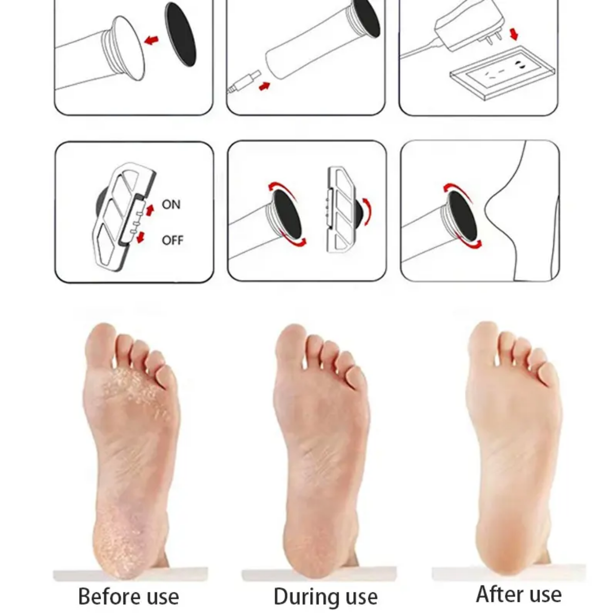Electric Foot Callus Remover & Pedicure File Set